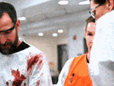 a man with blood on his shirt is standing next to a man in an orange vest