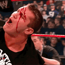 Randy Orton Bloody GIF - Randy Orton Bloody Blood GIFs