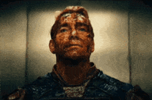 a man with blood on his face looks up