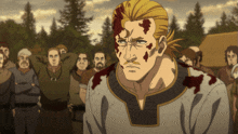 a man with blood on his face is standing in front of a group of people