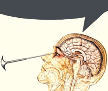 a drawing of a person 's head with a hammer pointing at the brain