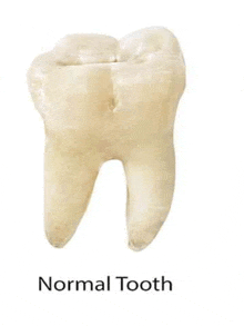 Normal Tooth GIF