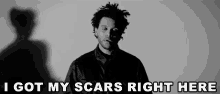I Got My Scars Right Here Scars GIF