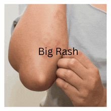 big rash