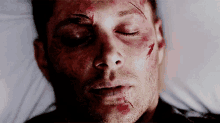 Supernatural Dean Winchester GIF - Supernatural Dean Winchester Inujured GIFs