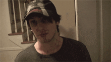 a man with blood on his face is wearing a hat that says abercrombie & fitch