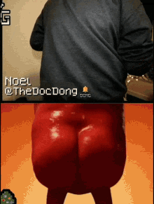the doc dong cheeks potato butt