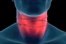 a man with barbed wire around his neck