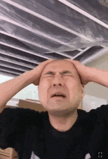 a bald man is holding his head with his hands while making a funny face .