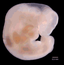 Fetus Baby GIF