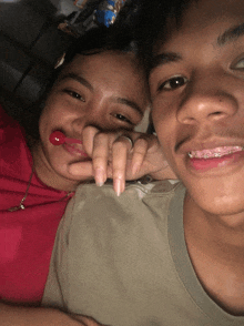 a boy and a girl are posing for a picture and the girl has braces on her teeth