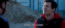 Jake Peralta I Have A Buise GIF - Jake Peralta I Have A Buise B99 GIFs