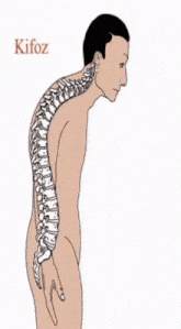a drawing of a man 's spine with the word kifoz on the top
