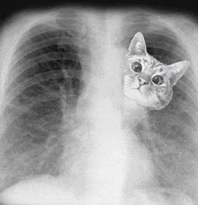 an x-ray of a cat looking out of a person 's lungs .