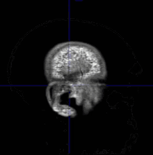 Mri Mri Human Brain GIF - Mri Mri Human Brain Mri Skull GIFs