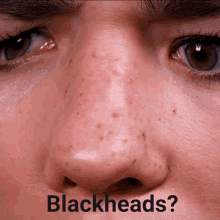 blackheads mirror distorted omg shocked