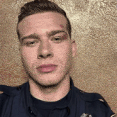a police officer with a bruise on his face