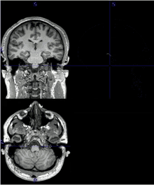 Mri Brain Scan GIF