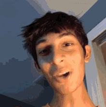 a young man with a black eye is making a funny face with his mouth open
