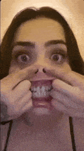 a woman with braces on her teeth is making a funny face with her hands .