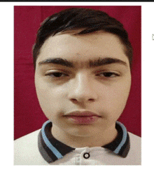 a close up of a young man 's face wearing a white shirt