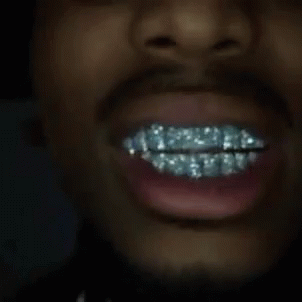 Dentist Diamond Grill GIF