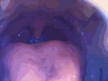 Endoscopy Medical GIF - Endoscopy Medical Deepthroat GIFs