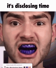 Its Disclosing Time Purple Teeth GIF - Its Disclosing Time Purple Teeth Teeth GIFs