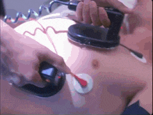 a close up of a person using a defibrillator on their chest