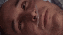 a close up of a man laying in a hospital bed with an oxygen mask on his nose .