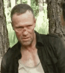 a man with a broken nose is standing in the woods .