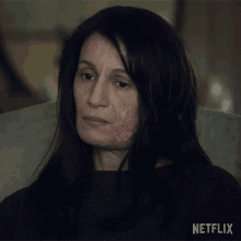 a woman with a scar on her face sits in a chair with netflix written on the bottom