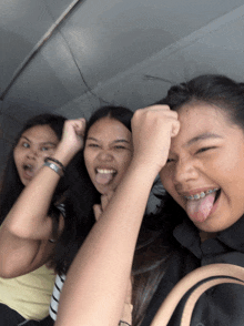 a girl with braces on her teeth is making a face with her tongue out