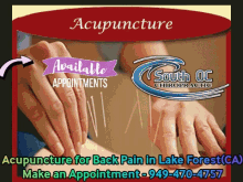 acupuncture in