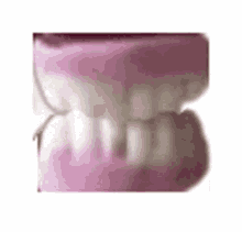 linzee teeth