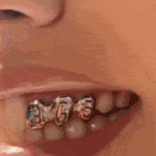 a close up of a person 's teeth with braces on them .