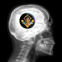 an x-ray of a person 's head shows a button with a girl on it