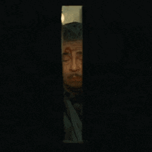 a man with blood on his face looks out a window