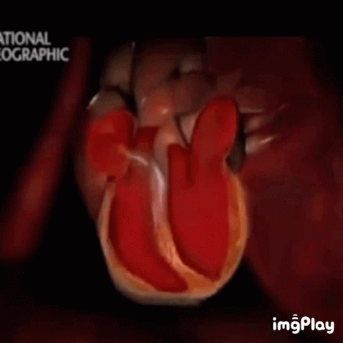 Ventricular Fibrillation GIF - Ventricular Fibrillation Heart GIFs