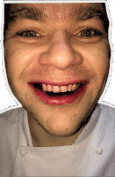 a close up of a man 's face with his mouth open and his teeth showing