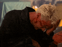 a man with a bloody head is covering his face with his hands