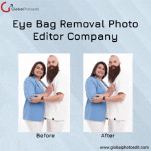 Eye Bag Removal Photo Editor Company GIF - Eye Bag Removal Photo Editor Company GIFs