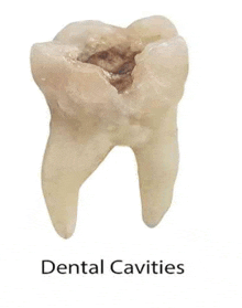 Dental Cavities GIF