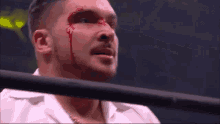 a man with blood coming out of his face is standing in a ring .