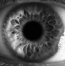 Retinaeye Pupil GIF