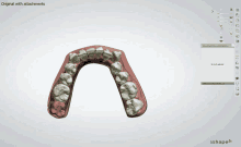 Verdun Teeth GIF - Verdun Teeth Dentures GIFs