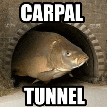 Carpal Tunnel GIF