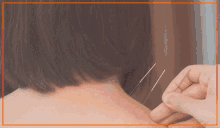 Acupuncture Treatment Clinic Best Acupuncture Treatment GIF - Acupuncture Treatment Clinic Best Acupuncture Treatment Acupuncture Treatment In Toronto GIFs
