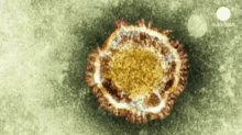 A New Virus Has The Medical World On Edge After It Was Found To Transmit From Person To Person. GIF - GIFs
