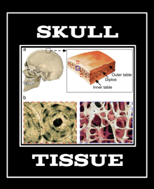 Skill Issue Skull Tissue GIF